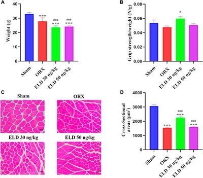 Eldecalcitol prevents muscle loss by suppressing PI3K/AKT/FOXOs pathway in orchiectomized mice